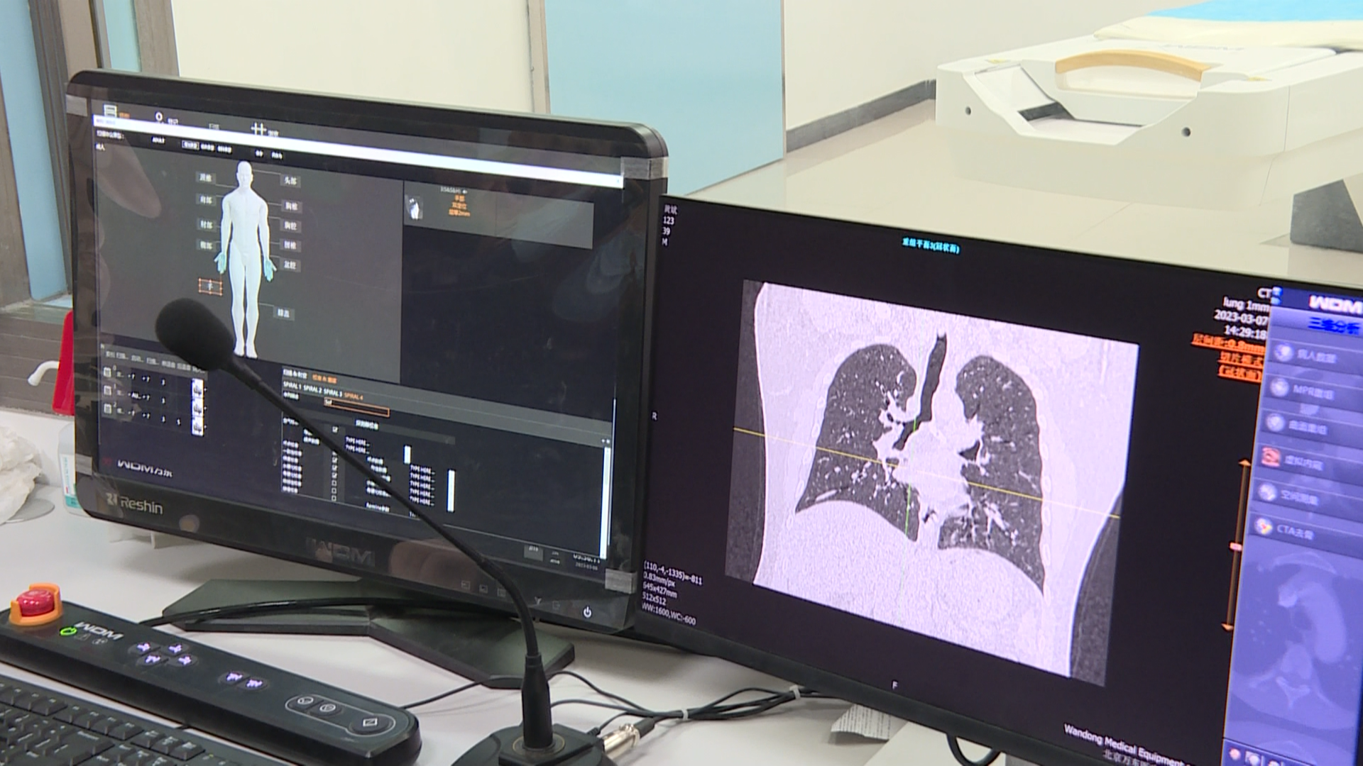 太行ct怎么样英山县石头咀中心卫生院CT设备投入使用 基层医疗服务能力再提升_https://www.jmylbn.com_新闻资讯_第5张