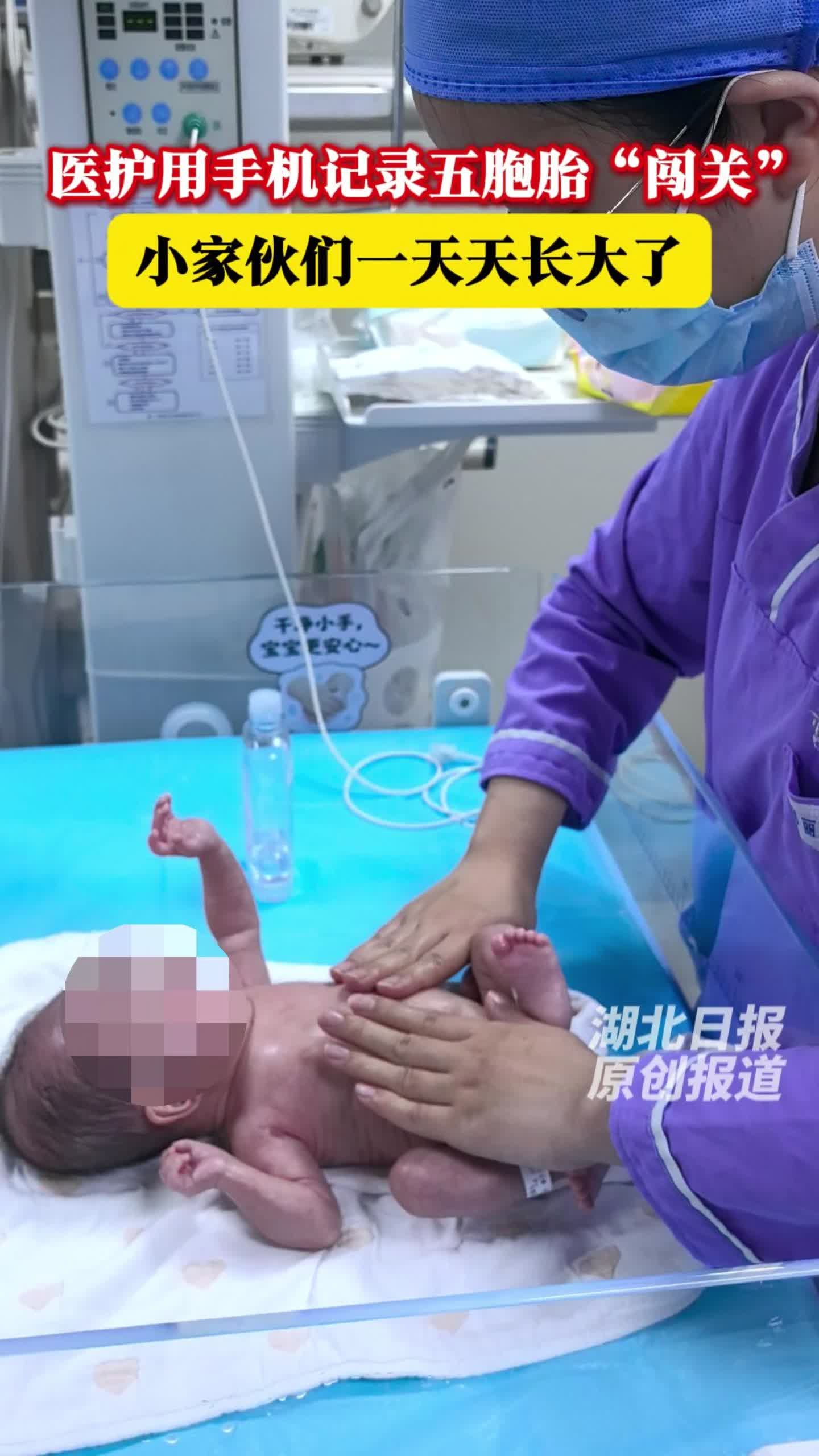 医护用手机记录五胞胎“闯关”  小家伙们一天天长大了