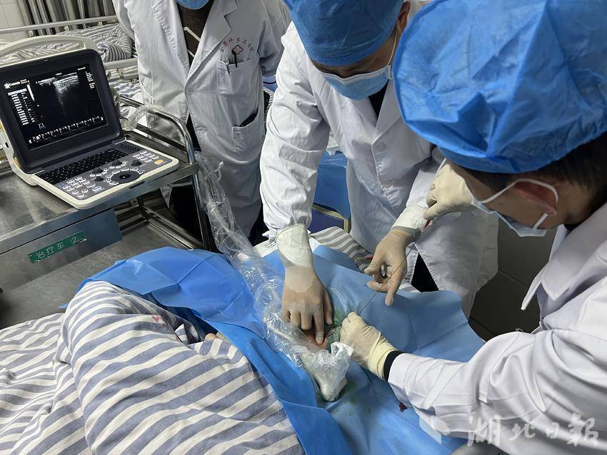 金果坪中心卫生院成功开展首例深静脉穿刺术